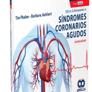ECG de 12 Derivaciones en Síndromes Coronarios Agudos. 4 Edición
