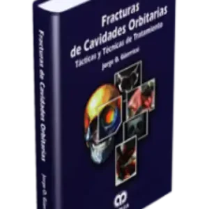 Fracturas de Cavidades Orbitarias
