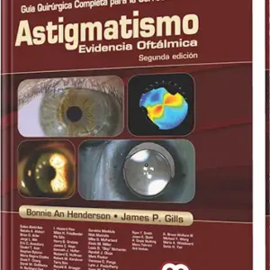 Guía Quirúrgica Completa para la Corrección del Astigmatismo. Evidencia Oftálmica