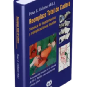 Reemplazo Total de Cadera