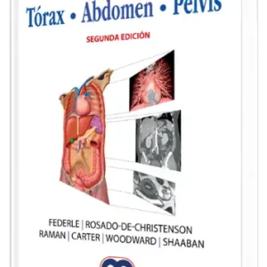 Imagenología Anatómica. Tórax, Abdomen, Pelvis. 2 Edición