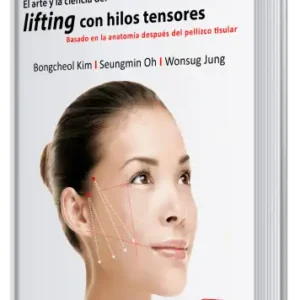 El Arte y la Ciencia del Lifting con Hilos Tensores. Basado en la Anatomía Después del Pellizco Tisular