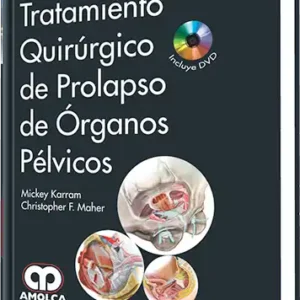 Tratamiento Quirúrgico de Prolapso de Órganos Pélvicos