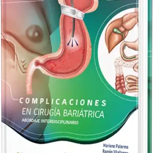 Complicaciones en Cirugía Bariátrica. Abordaje interdisciplinario.