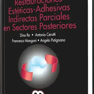 Restauraciones Estéticas-Adhesivas Indirectas Parciales en Sectores Posteriores