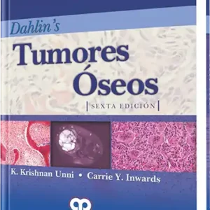 Tumores Óseos 6 edición