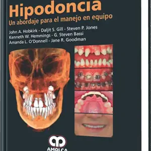 Hipodoncia