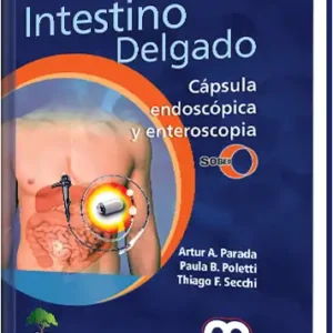 Intestino Delgado. Cápsula Endoscópica y Enteroscopia