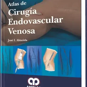Atlas de Cirugía Endovascular Venosa