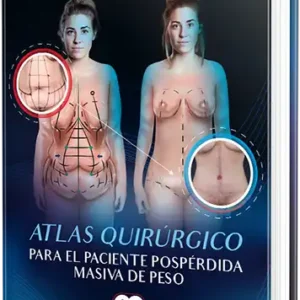 Atlas quirúrgico para el paciente pospérdida masiva de peso