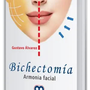 Bichectomía. Armonía Facial