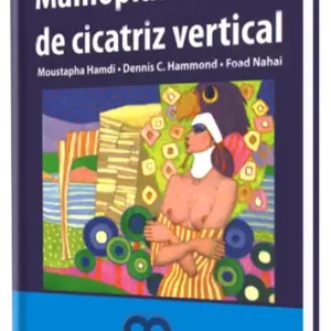 Mamoplastia de Cicatriz Vertical