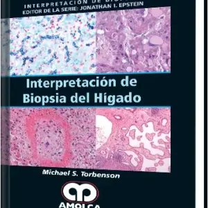 Interpretación de Biopsia del Hígado