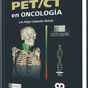 PET / CT en Oncología