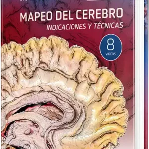 Mapeo del cerebro