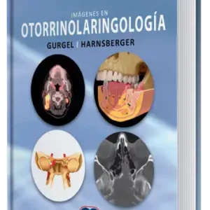 Imágenes en Otorrinolaringología