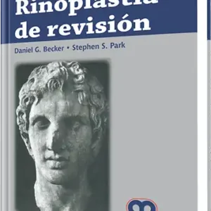 Rinoplastia de Revisión