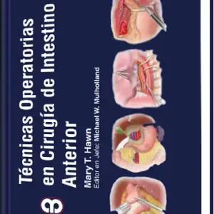 Técnicas Operatorias en Cirugía de Intestino Anterior