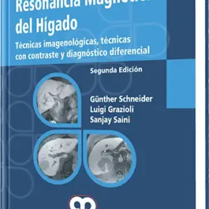 Resonancia Magnética del Hígado 2 Edición