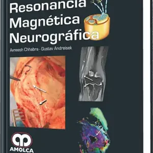 Resonancia Magnética Neurográfica